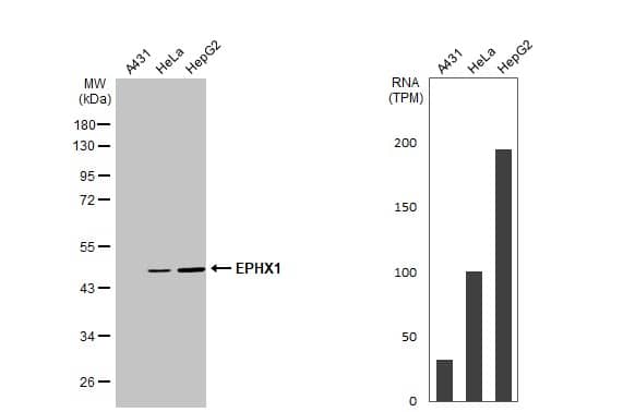 Various whole cell extracts (30 ug) were separated by 10% SDS-PAGE, and the membrane was blotted with EPHX1 antibody (NBP1-33011) diluted at 1:1000. The HRP-conjugated anti-rabbit IgG antibody  was used to detect the primary antibody. Corresponding RNA expression data for the same cell lines are based on Human Protein Atlas program. 