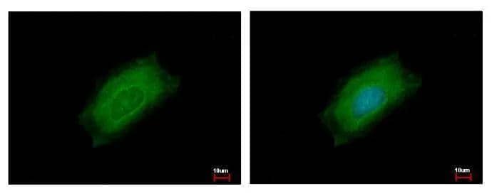 Cyclin B2 antibody [N1C3-2] detects CCNB2 protein at cytoplasm by immunofluorescent analysis. Sample: HeLa cells were fixed in ice-cold MeOH for 5 min.Green: CCNB2 protein stained by Cyclin B2 antibody [N1C3-2] (NBP1-33031) diluted at 1:500.Blue: Hoechst 33343 staining. 
