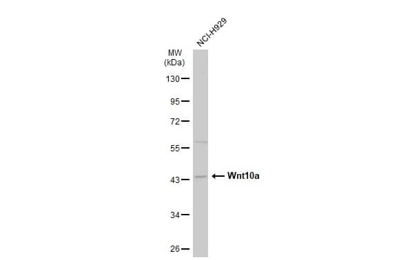 Western Blot: Wnt-10a Antibody [NBP1-33039] - Whole cell extract (30 ug) was separated by 10% SDS-PAGE, and the membrane was blotted with Wnt-10a antibody [N1C1-2] (NBP1-33039) diluted at 1:1000. The HRP-conjugated anti-rabbit IgG antibody  was used to detect the primary antibody, and the signal was developed with Trident ECL plus-Enhanced.