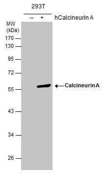 Western Blot: Calcineurin A Antibody [NBP1-33041] - Calcineurin A antibody detects Calcineurin A protein by Western blot analysis. Non-transfected (-) and Calcineurin A-transfected (+) 293T whole cell extracts (30 ug) were separated by 10% SDS-PAGE, and the membrane was blotted with Calcineurin A antibody (NBP1-33041) diluted at 1:1000.