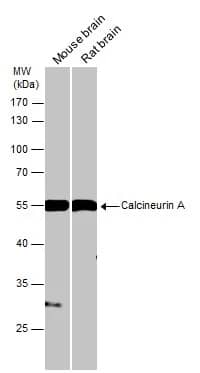 Western Blot: Calcineurin A Antibody [NBP1-33041] - Various tissue extracts (50 ug) were separated by 10% SDS-PAGE, and the membrane was blotted with Calcineurin A antibody (NBP1-33041) diluted at 1:1000.