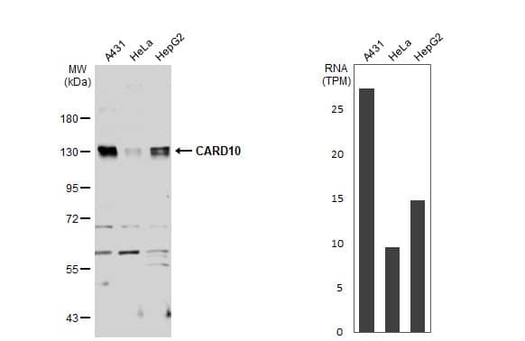 <b>Orthogonal Strategies Validation. </b>Western Blot: CARD10 Antibody [NBP1-33042] - Various whole cell extracts (30 ug) were separated by 7.5% SDS-PAGE, and the membrane was blotted with CARD10 antibody [N2C1], Internal  diluted at 1:1000. The HRP-conjugated anti-rabbit IgG antibody  was used to detect the primary antibody. Corresponding RNA expression data for the same cell lines are based on Human Protein Atlas program.