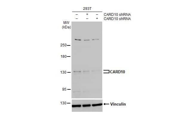 <b>Genetic Strategies Validation. </b>Western Blot: CARD10 Antibody [NBP1-33042] - Non-transfected (–) and transfected (+) 293T whole cell extracts (30 ug) were separated by 5% SDS-PAGE, and the membrane was blotted with CARD10 antibody [N2C1], Internal  diluted at 1:1000. The HRP-conjugated anti-rabbit IgG antibody  was used to detect the primary antibody.