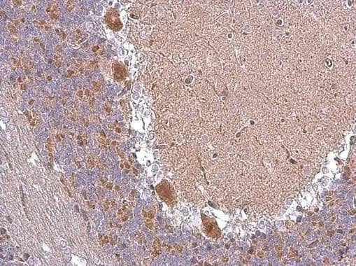 ABAT antibody detects ABAT protein at cytoplasm in rat brain by immunohistochemical analysis. Sample: Paraffin-embedded rat brain. ABAT antibody (NBP1-33066) diluted at 1:500.Antigen Retrieval: Trilogy(TM) (EDTA based, pH 8.0) buffer, 15min 