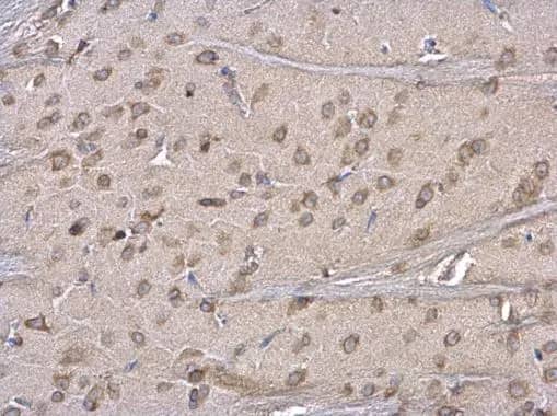 Immunohistochemistry: ERP29 Antibody [NBP1-33076] - ERP29 antibody detects ERP29 protein at cytosol on rat fore brain by immunohistochemical analysis. Sample: Paraffin-embedded rat fore brain. ERP29 antibody (NBP1-33076) dilution: 1:500.Antigen Retrieval: Trilogy™ (EDTA based, pH 8.0) buffer, 15min