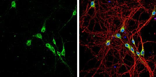 LGI1 antibody [N2C2], Internal detects LGI1 protein by immunofluorescent analysis.Sample: DIV10 rat E18 primary hippocampal neurons were fixed in 4% paraformaldehyde at RT for 15 min.Green: LGI1 protein stained by LGI1 antibody [N2C2], Internal (NBP1-33087) diluted at 1:500.Red: beta Tubulin 3/ Tuj1, stained by beta Tubulin 3/ Tuj1 antibody [GT1338]  diluted at 1:500.Blue: Fluoroshield with DAPI . 