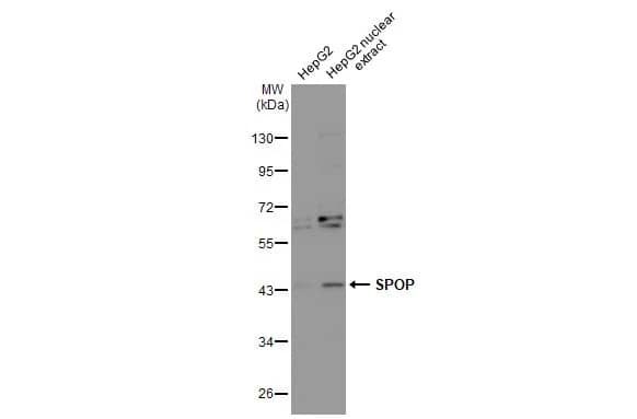 Western Blot: SPOP Antibody [NBP1-33090] - HepG2 whole cell and nuclear extracts (30 ug) were separated by 10% SDS-PAGE, and the membrane was blotted with SPOP antibody [N1C1] (NBP1-33090) diluted at 1:1000. The HRP-conjugated anti-rabbit IgG antibody  was used to detect the primary antibody.