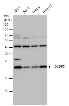 Western Blot: VHR/DUSP3 Antibody [NBP1-33099] - VHR/DUSP3 antibody detects VHR/DUSP3 protein by western blot analysis. Various whole cell extracts (30 ug) were separated by 15 % SDS-PAGE, and blotted with VHR/DUSP3 antibody (NBP1-33099) diluted by 1:1000