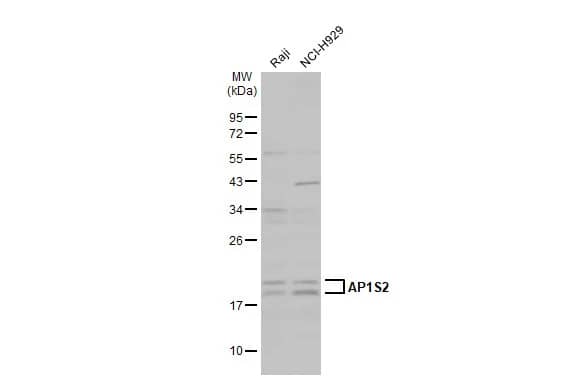 Western Blot: AP1S2 Antibody [NBP1-33101] - Various whole cell extracts (30 ug) were separated by 12% SDS-PAGE, and the membrane was blotted with AP1S2 antibody (NBP1-33101) diluted at 1:1000. The HRP-conjugated anti-rabbit IgG antibody  was used to detect the primary antibody, and the signal was developed with Trident ECL plus-Enhanced.