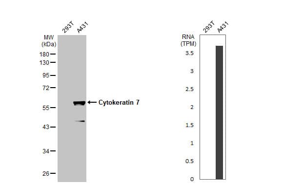 <b>Orthogonal Strategies Validation. </b>Western Blot: Cytokeratin 7 Antibody [NBP1-33104] - Various whole cell extracts (30 ug) were separated by 10% SDS-PAGE, and the membrane was blotted with Cytokeratin 7 antibody [N1C2]  diluted at 1:20000. The HRP-conjugated anti-rabbit IgG antibody  was used to detect the primary antibody. Corresponding RNA expression data for the same cell lines are based on Human Protein Atlas program.