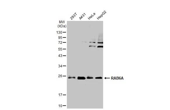 Western Blot: RAB6A Antibody [NBP1-33110] - Various whole cell extracts (30 ug) were separated by 12% SDS-PAGE, and the membrane was blotted with RAB6A antibody (NBP1-33110) diluted at 1:500. The HRP-conjugated anti-rabbit IgG antibody  was used to detect the primary antibody.