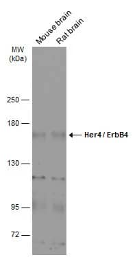 Western Blot: ErbB4/Her4 Antibody [NBP1-33120] - Various tissue extracts (50 ug) were separated by 5% SDS-PAGE, and the membrane was blotted with ErbB4/Her4 antibody [C1C3] (NBP1-33120) diluted at 1:1000. The HRP-conjugated anti-rabbit IgG antibody  was used to detect the primary antibody.