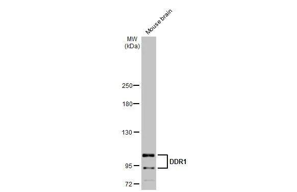 Mouse tissue extract (50 ug) was separated by 5% SDS-PAGE, and the membrane was blotted with DDR1 antibody [N1N3] (NBP1-33134) diluted at 1:500. The HRP-conjugated anti-rabbit IgG antibody  was used to detect the primary antibody. 