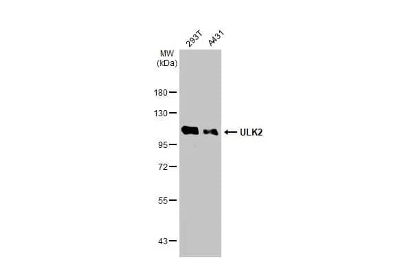 Western Blot: ULK2 Antibody [NBP1-33136] - Various whole cell extracts (30 ug) were separated by 7.5% SDS-PAGE, and the membrane was blotted with ULK2 antibody [C2C3], C-term (NBP1-33136) diluted at 1:500. The HRP-conjugated anti-rabbit IgG antibody  was used to detect the primary antibody.