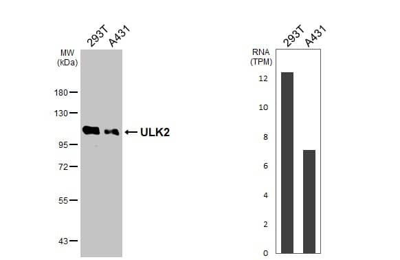Various whole cell extracts (30 ug) were separated by 7.5% SDS-PAGE, and the membrane was blotted with ULK2 antibody [C2C3], C-term (NBP1-33136) diluted at 1:500. The HRP-conjugated anti-rabbit IgG antibody  was used to detect the primary antibody.Corresponding RNA expression data for the same cell lines are based on Human Protein Atlas program. 