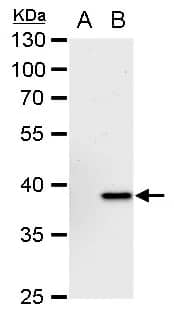 Western Blot: Chitinase 3-like 2 Antibody [NBP1-33193] - Chitinase 3-like 2 antibody [N1C3] detects Chitinase 3-like 2 protein by Western blot analysis.A. 30 ug 293T whole cell extract B. 30 ug whole extract of human CHI3L2-transfected 293T cells10 % SDS-PAGEChitinase 3-like 2 antibody [N1C3] (NBP1-33193) dilution: 1:5000