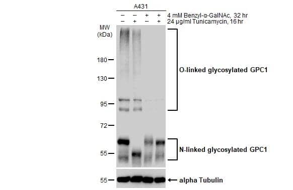 Untreated (-) and treated (+) A431 whole cell extracts (30 ug) were separated by 7.5% SDS-PAGE, and the membrane was blotted with Glypican 1 antibody [N3C3] (NBP1-33197) diluted at 1:3000. The HRP-conjugated anti-rabbit IgG antibody  was used to detect the primary antibody. 