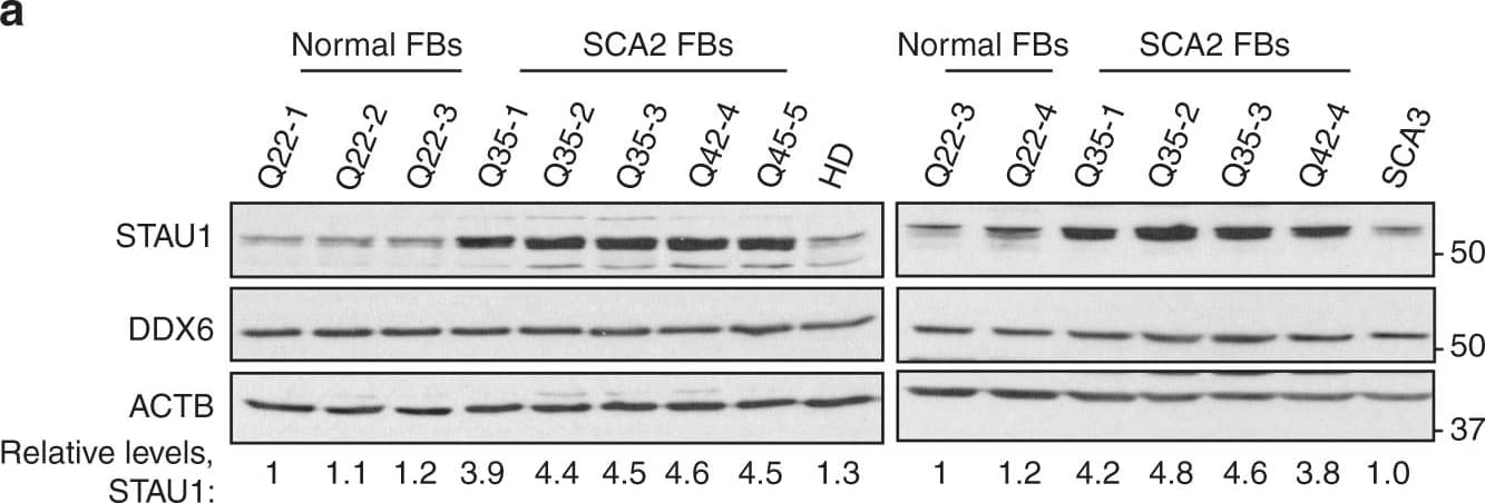 Staufen1 protein but not mRNA steady-state levels are increased in neurodegenerative disease cells & tissues. Western blot analysis of SCA2- FBs (a) & LBCs (b) show increased STAU1 levels compared with normal controls. DDX6 levels are unchanged. HD & SCA3 patient (polyQ expanded) FBs were used as additional controls. Four normal & five SCA2 FBs, & two normal & three SCA2 LBCs were used. c, d Western blot analyses of ATXN2Q127 (c) & BAC-Q72 (d) mouse cerebellar extracts (24 weeks of age) showing increased Stau1 levels compared with wild-type or BAC-Q22 controls (n = 2–3 animals per group). e Western blot of FB extracts from an ALS patient with the TDP-43G298S mutation show increased STAU1 levels.  beta -Actin was used as loading control & representative blots of three independent experiments are shown. f–hSTAU1 RNA levels are unaltered in SCA2 & ALS cells & SCA2 mice. qRT-PCR analyses of STAU1 mRNA in SCA2 FBs & ALS FB with TDP-43G298S mutation (f) or SCA2 LBCs (g). h qRT-PCR analyses of cerebellar RNAs from ATXN2Q127 & BAC-Q72 mice compared to wild-type littermates (24 weeks of age; n = animals per group). Gene expression levels were normalized to Actb Image collected & cropped by CiteAb from the following publication (//pubmed.ncbi.nlm.nih.gov/30194296), licensed under a CC-BY license. Not internally tested by Novus Biologicals.