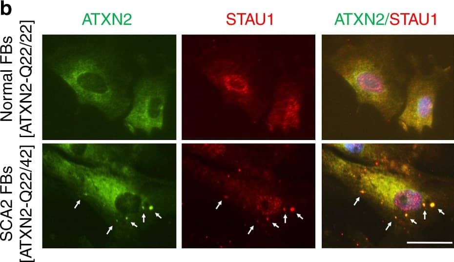 Western Blot: Staufen Antibody [NBP1-33202] - Co-localization of Staufen1 with ATXN2 in stress-granule-like structures. a ATXN2 & STAU1 co-localize in SGs. Immunostaining of HEK-293 cells with antibodies against ATXN2, STAU1, & TIA-1 show co-localization of STAU1 with ATXN2 & TIA-1 in SGs during stress (0.5 mM sodium arsenite for 15 & 30 min) that are not present in the absence of stress. Scale bar, 10 µM. b Constitutively present SG-like structures positive for both ATXN2 & STAU1 in SCA2 FBs, but not in normal FBs (white arrows). Cells were stained with antibodies to ATXN2 & STAU1. Scale bar, 100 µM. c Increased numbers of aggregates in SCA2 FBs at 37 °C. Aggregates > 4 pixels per cell positive for both ATXN2 & STAU1 are shown. One-hundred normal & 96 SCA2-FBs were used for analyses. Data are mean ± SD, **P < 0.01, Student t-test. d Histograms representing the quantities & sizes of ATXN2-STAU1 co-localized granules in normal vs. SCA2 FBs. e In vivo co-localization of ATXN2 (green) with Stau1 (red) to aggregates in cerebellar PCs of 24-weeks-old ATXN2Q127 mice (white arrows). Scale bar, 30 µM. f Co-localized ATXN2 (red) & STAU1 (green) to aggregates (white arrows) in cerebellar PCs from a human SCA2 brain, that are absent in an unaffected control. Scale bar, 30 µM. g Immunoprecipitation of ATXN2 with STAU1. Non-RNase A or RNase A treated HEK-293 cell extracts expressing Flag-tagged ATXN2-(Q22 or Q108) were subjected to immunoprecipitation with Flag mAb beads & analyzed by western blotting. STAU1 shows RNA-dependent interactions with wild-type & mutant ATXN2. ATXN2 also co-immunoprecipitates with DDX6 & PABPC1, known ATXN2 interactors. Representative blots of three independent experiments are shown Image collected & cropped by CiteAb from the following publication (//pubmed.ncbi.nlm.nih.gov/30194296), licensed under a CC-BY license. Not internally tested by Novus Biologicals.
