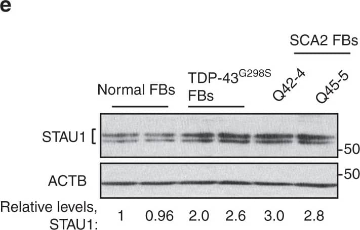 Western Blot: Staufen Antibody [NBP1-33202] - Staufen1 protein but not mRNA steady-state levels are increased in neurodegenerative disease cells & tissues. Western blot analysis of SCA2- FBs (a) & LBCs (b) show increased STAU1 levels compared with normal controls. DDX6 levels are unchanged. HD & SCA3 patient (polyQ expanded) FBs were used as additional controls. Four normal & five SCA2 FBs, & two normal & three SCA2 LBCs were used. c, d Western blot analyses of ATXN2Q127 (c) & BAC-Q72 (d) mouse cerebellar extracts (24 weeks of age) showing increased Stau1 levels compared with wild-type or BAC-Q22 controls (n = 2–3 animals per group). e Western blot of FB extracts from an ALS patient with the TDP-43G298S mutation show increased STAU1 levels.  beta -Actin was used as loading control & representative blots of three independent experiments are shown. f–hSTAU1 RNA levels are unaltered in SCA2 & ALS cells & SCA2 mice. qRT-PCR analyses of STAU1 mRNA in SCA2 FBs & ALS FB with TDP-43G298S mutation (f) or SCA2 LBCs (g). h qRT-PCR analyses of cerebellar RNAs from ATXN2Q127 & BAC-Q72 mice compared to wild-type littermates (24 weeks of age; n = animals per group). Gene expression levels were normalized to Actb Image collected & cropped by CiteAb from the following publication (//pubmed.ncbi.nlm.nih.gov/30194296), licensed under a CC-BY license. Not internally tested by Novus Biologicals.