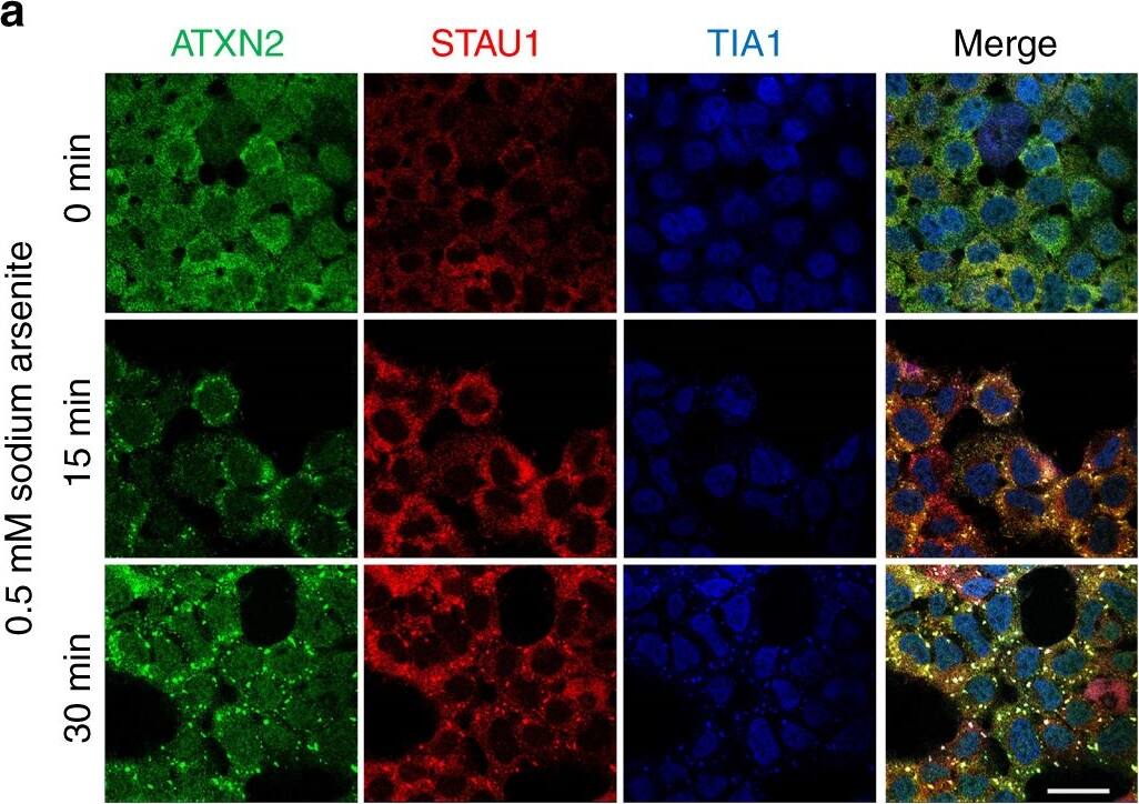 Western Blot: Staufen Antibody [NBP1-33202] - Co-localization of Staufen1 with ATXN2 in stress-granule-like structures. a ATXN2 & STAU1 co-localize in SGs. Immunostaining of HEK-293 cells with antibodies against ATXN2, STAU1, & TIA-1 show co-localization of STAU1 with ATXN2 & TIA-1 in SGs during stress (0.5 mM sodium arsenite for 15 & 30 min) that are not present in the absence of stress. Scale bar, 10 µM. b Constitutively present SG-like structures positive for both ATXN2 & STAU1 in SCA2 FBs, but not in normal FBs (white arrows). Cells were stained with antibodies to ATXN2 & STAU1. Scale bar, 100 µM. c Increased numbers of aggregates in SCA2 FBs at 37 °C. Aggregates > 4 pixels per cell positive for both ATXN2 & STAU1 are shown. One-hundred normal & 96 SCA2-FBs were used for analyses. Data are mean ± SD, **P < 0.01, Student t-test. d Histograms representing the quantities & sizes of ATXN2-STAU1 co-localized granules in normal vs. SCA2 FBs. e In vivo co-localization of ATXN2 (green) with Stau1 (red) to aggregates in cerebellar PCs of 24-weeks-old ATXN2Q127 mice (white arrows). Scale bar, 30 µM. f Co-localized ATXN2 (red) & STAU1 (green) to aggregates (white arrows) in cerebellar PCs from a human SCA2 brain, that are absent in an unaffected control. Scale bar, 30 µM. g Immunoprecipitation of ATXN2 with STAU1. Non-RNase A or RNase A treated HEK-293 cell extracts expressing Flag-tagged ATXN2-(Q22 or Q108) were subjected to immunoprecipitation with Flag mAb beads & analyzed by western blotting. STAU1 shows RNA-dependent interactions with wild-type & mutant ATXN2. ATXN2 also co-immunoprecipitates with DDX6 & PABPC1, known ATXN2 interactors. Representative blots of three independent experiments are shown Image collected & cropped by CiteAb from the following publication (//pubmed.ncbi.nlm.nih.gov/30194296), licensed under a CC-BY license. Not internally tested by Novus Biologicals.