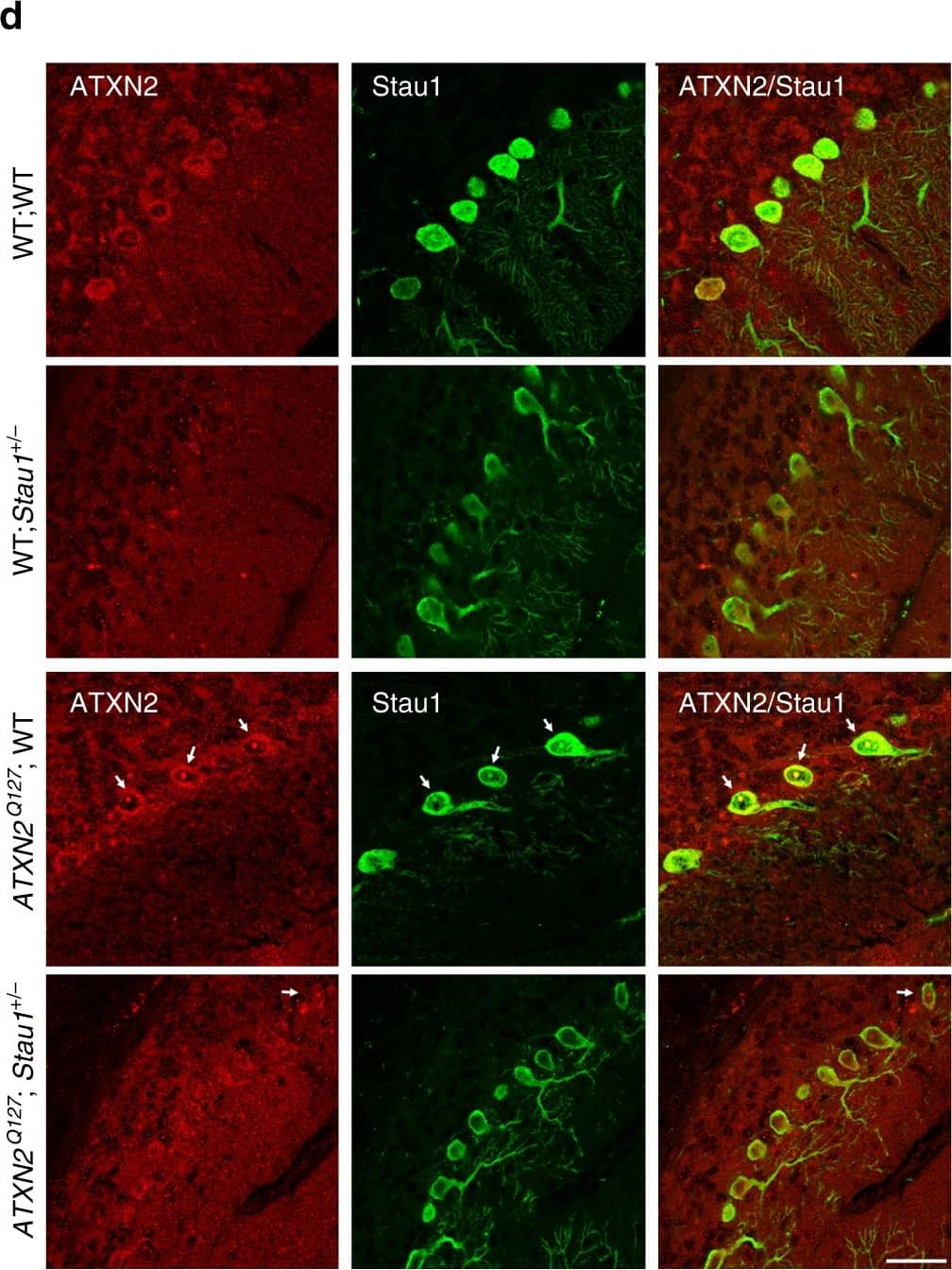 Western Blot: Staufen Antibody [NBP1-33202] - Silencing of STAU1 mitigates SCA2 phenotypes. aStau1 haploinsufficiency improves abnormal motor behavior of ATXN2Q127 mice as determined by rotarod behavior at 8, 12, 16, & 20 weeks of age. ATXN2Q127;Stau1+/- mice (green) have improved rotarod performance compared with ATXN2Q127 littermates (red) starting at 12 weeks of age. Note that Stau1 haploinsufficiency (orange) by itself does not alter motor function; n = 9–15 mice per group. Values shown are mean ± SE. Significance was determined using generalized estimating equations (GEE). NS, nonsignificant, *P < 0.05, **P < 0.01. b, c Reduction of Stau1 in vivo improves levels of key cerebellar proteins towards normalization. b Western blotting of cerebellar extracts from ATXN2Q127;Stau1+/- mice showing improvement of protein levels for Calb1, Pcp2, Rgs8, Pcp4, Homer3, & Fam107b towards normalization. Each lane represents cerebellar extract from an individual mouse.  beta -Actin is used as a loading control & the blots are from three replicate experiments. c Quantitative analysis of western blots shown in b. Data are mean ± SD, **P < 0.01, ***P < 0.001, Student t-test. d Combined immunostaining of ATXN2 (red) & Stau1 (green) of cerebellar sections from ATXN2Q127 & crossed ATXN2Q127;Stau1+/- mice (34 weeks of age) demonstrating reduced ATXN2-Stau1 aggregates in crossed ATXN2Q127;Stau1+/- mice. Scale bar, 30 µM. e Model for STAU1 in the pathology of SCA2 & other neurodegenerative diseases Image collected & cropped by CiteAb from the following publication (//pubmed.ncbi.nlm.nih.gov/30194296), licensed under a CC-BY license. Not internally tested by Novus Biologicals.