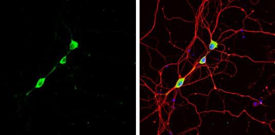 Western Blot: Staufen Antibody [NBP1-33202] - Silencing of STAU1 mitigates SCA2 phenotypes. aStau1 haploinsufficiency improves abnormal motor behavior of ATXN2Q127 mice as determined by rotarod behavior at 8, 12, 16, & 20 weeks of age. ATXN2Q127;Stau1+/- mice (green) have improved rotarod performance compared with ATXN2Q127 littermates (red) starting at 12 weeks of age. Note that Stau1 haploinsufficiency (orange) by itself does not alter motor function; n = 9–15 mice per group. Values shown are mean ± SE. Significance was determined using generalized estimating equations (GEE). NS, nonsignificant, *P  4 pixels per cell positive for both ATXN2 & STAU1 are shown. One-hundred normal & 96 SCA2-FBs were used for analyses. Data are mean ± SD, **P  4 pixels per cell positive for both ATXN2 & STAU1 are shown. One-hundred normal & 96 SCA2-FBs were used for analyses. Data are mean ± SD, **P  4 pixels per cell positive for both ATXN2 & STAU1 are shown. One-hundred normal & 96 SCA2-FBs were used for analyses. Data are mean ± SD, **P Sample: DIV9 rat E18 primary hippocampal neuron cells were fixed in 4% paraformaldehyde at RT for 15 min.Green: Staufen stained by Staufen antibody (NBP1-33202) diluted at 1:500.Red: beta Tubulin 3/ Tuj1, stained by beta Tubulin 3/ Tuj1 antibody [GT11710]  diluted at 1:500.Blue: Fluoroshield with DAPI . 