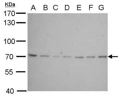 Western Blot: Lamin B2 Antibody [NBP1-33205] - Lamin B2 antibody [N3C2], Internal detects LMNB2 protein by western blot analysis.A. 30 ug Neuro2A whole cell lysate/extract B. 30 ug GL261 whole cell lysate/extract C. 30 ug C8D30 whole cell lysate/extract D. 30 ug NIH-3T3 whole cell lysate/extract E. 30 ug BCL-1 lysate/extract F. 30 ug Raw264.7 whole cell lysate/extract G. 30 ug C2C12 whole cell lysate/extract7.5% SDS-PAGELamin B2 antibody [N3C2], Internal (NBP1-33205) dilution: 1:500 The HRP-conjugated anti-rabbit IgG antibody  was used to detect the primary antibody.