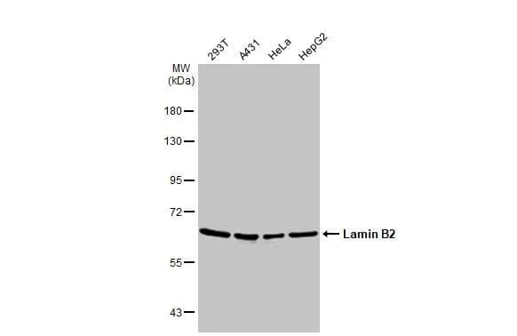 Various whole cell extracts (30 ug) were separated by 7.5% SDS-PAGE, and the membrane was blotted with Lamin B2 antibody [N3C2], Internal (NBP1-33205) diluted at 1:1000. The HRP-conjugated anti-rabbit IgG antibody  was used to detect the primary antibody. 