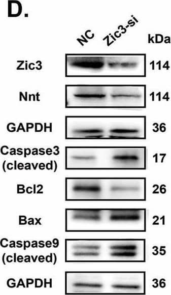 Zic3-ApoM-Nnt axis mediates cell homeostasis between mitophagy and apoptosis.A, C, D C17.2 cells were transfected with Ncontrol (NC) or siRNA targeting Zic3 (Zic3-si). B, E C17.2 cells were transfected with empty pcDNA vector (Vector) or WT Zic3 cDNA (Zic3-oe). A, B PINK1, PRKN and LC3-II/LC3-I protein levels in mitochondria were measured by western blotting (n = 3 from independent experiments). C C17.2 cells were double IF-stained with LC3-labelled autophagosomes (green) and TOMM20-labelled mitochondria (red). Nuclei were counterstained with DAPI. Scale bar = 10 um. D, E Nnt, Bax/Bcl-2, cleaved Caspase 9, and cleaved Caspase 3 protein levels were analysed by western blotting (n = 3 independent experiments). F, G PINK1, PRKN and LC3-II/LC3-I protein levels in mitochondria were analysed by western blotting under different transfection conditions in C17.2 cells (n = 3 from independent experiments). H, I Nnt, cleaved Caspase 9, cleaved Caspase 3, and Bax/Bcl-2 protein levels were analysed by western blotting under different transfection conditions in C17.2 cells (n = 3 from independent experiments). GAPDH or VDAC1 was used as a loading control. Data are expressed as the mean +/- SD. Statistical comparisons were performed using Student’s t tests in (A, B, D and E); one-way ANOVA in (F and G). *P < 0.05; **P < 0.01; “ns