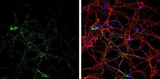GAD65 antibody detects GAD65 protein by immunofluorescent analysis.Sample: DIV9 rat E18 primary hippocampal neuron cells were fixed in 4% paraformaldehyde at RT for 15 min.Green: GAD65 stained by GAD65 antibody (NBP1-33284) diluted at 1:500.Red: beta Tubulin 3/ Tuj1, stained by beta Tubulin 3/ Tuj1 antibody [GT11710]  diluted at 1:500.Blue: Fluoroshield with DAPI . 