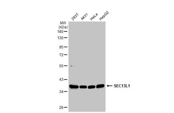 Western Blot: SEC13 Antibody [NBP1-33291] - Various whole cell extracts (30 ug) were separated by 10% SDS-PAGE, and the membrane was blotted with SEC13 antibody [N1C3] (NBP1-33291) diluted at 1:1000. The HRP-conjugated anti-rabbit IgG antibody  was used to detect the primary antibody.