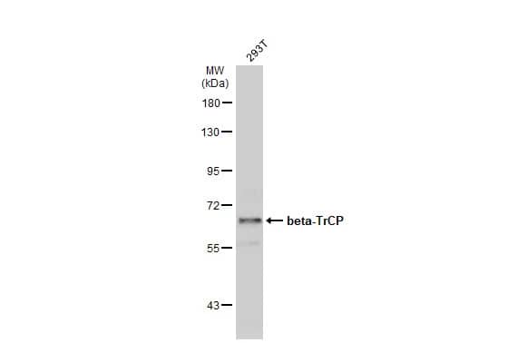 Western Blot: beta-TrCP1/BTRC Antibody [NBP1-33301] - Whole cell extract (30 ug) was separated by 7.5% SDS-PAGE, and the membrane was blotted with beta-TrCP1/BTRC antibody [N1C1] (NBP1-33301) diluted at 1:500. The HRP-conjugated anti-rabbit IgG antibody  was used to detect the primary antibody.