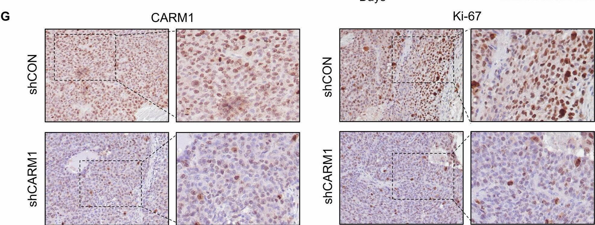 CARM1 promotes the proliferation of HCC cells.A Western blotting analysis showed the knockdown efficacy of CARM1 in Huh7 and PLC/PRF/5 cells infected with lentiviral particles expressing shRNAs targeting CARM1. B Proliferation of control and CARM1-knockdown Huh7 cells was detected by CCK-8 assays on the indicated days. C Colony formation assays were performed to detect the proliferation of control and CARM1-knockdown HCC cells. The data are presented in a bar chart. D Control or CARM1-knockdown Huh7 cells were subcutaneously injected into nude mice for observation of tumor growth. E The tumor volume was measured every three days and is presented as a line graph. F The tumor weights of the xenografts from the different groups were calculated. G Immunohistochemical analysis of mouse subcutaneous tumors was performed with anti-CARM1 and anti-Ki-67 antibodies. (n = 3; *p < 0.05, **p < 0.01, and ***p < 0.001). Image collected and cropped by CiteAb from the following open publication (//pubmed.ncbi.nlm.nih.gov/40016178), licensed under a CC-BY license. Not internally tested by Novus Biologicals.