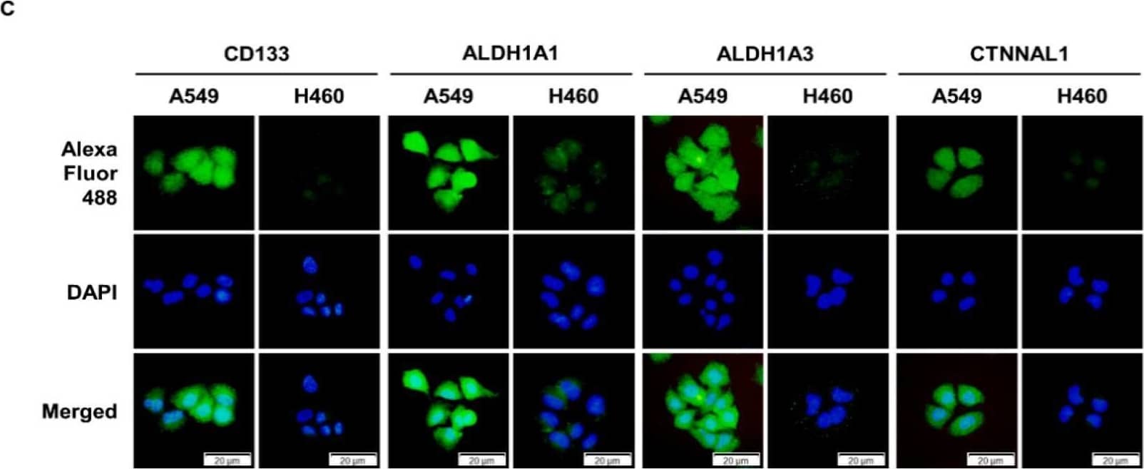 Immunocytochemistry/ Immunofluorescence CTNNAL1 Antibody - BSA Free