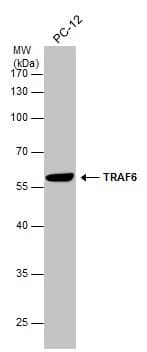 Western Blot: TRAF-6 Antibody [NBP1-33357] - Whole cell extract (30 ug) was separated by 10% SDS-PAGE, and the membrane was blotted with TRAF-6 antibody [N2C2], Internal (NBP1-33357) diluted at 1:1000.