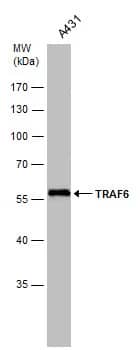 Western Blot: TRAF-6 Antibody [NBP1-33357] - Whole cell extract (30 ug) was separated by 10% SDS-PAGE, and the membrane was blotted with TRAF-6 antibody [N2C2], Internal (NBP1-33357) diluted at 1:2000.