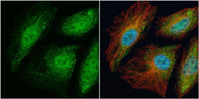TRAF6 antibody [N2C2], Internal detects TRAF6 protein at cytoplasm and nucleus by immunofluorescent analysis.Sample: HeLa cells were fixed in 4% paraformaldehyde at RT for 15 min.Green: TRAF6 protein stained by TRAF6 antibody [N2C2], Internal (NBP1-33357) diluted at 1:100.Red: alpha Tubulin, a cytoskeleton marker, stained by alpha Tubulin antibody [GT114]  diluted at 1:1000.Blue: Hoechst 33342 staining. 