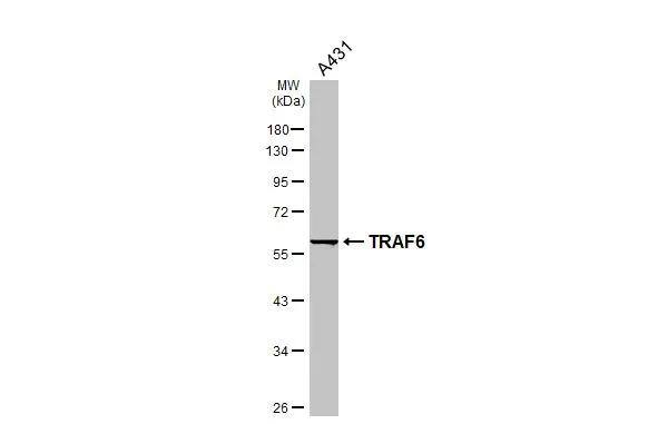 Whole cell extract (30 ug) was separated by 10% SDS-PAGE, and the membrane was blotted with TRAF6 antibody [N2C2], Internal (NBP1-33357) diluted at 1:2000. The HRP-conjugated anti-rabbit IgG antibody  was used to detect the primary antibody. 