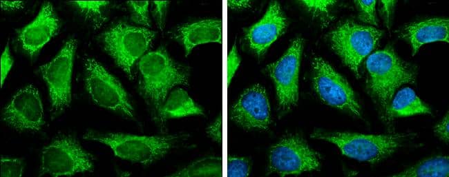 SLC25A13 antibody [N3C2], Internal detects SLC25A13 protein at mitochondria by immunofluorescent analysis.Sample: HeLa cells were fixed in 4% paraformaldehyde at RT for 15 min.Green: SLC25A13 protein stained by SLC25A13 antibody [N3C2], Internal (NBP1-33380) diluted at 1:500.Blue: Hoechst 33342 staining. 