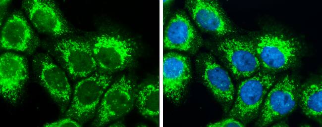 Immunocytochemistry/ Immunofluorescence: SLC25A22 Antibody [NBP1-33385] - SLC25A22 antibody [N1C3] detects SLC25A22 protein at mitochondria by immunofluorescent analysis.Sample: A431 cells were fixed in 4% paraformaldehyde at RT for 15 min.Green: SLC25A22 protein stained by SLC25A22 antibody [N1C3] (NBP1-33385) diluted at 1:200.Blue: Hoechst 33342 staining.