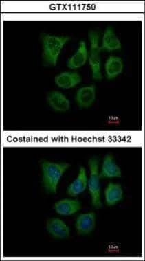 Immunofluorescence analysis of methanol-fixed Hep3B, using GALK2(NBP1-33401) antibody at 1:500 dilution. 