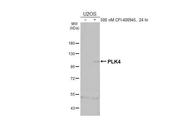 Western Blot PLK4 Antibody