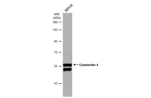 Western Blot: Cytokeratin 4 Antibody [NBP1-33412] - Whole cell extract (30 ug) was separated by 7.5% SDS-PAGE, and the membrane was blotted with Cytokeratin 4 antibody (NBP1-33412) diluted at 1:1000. The HRP-conjugated anti-rabbit IgG antibody  was used to detect the primary antibody, and the signal was developed with Trident ECL plus-Enhanced.