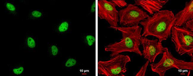 ZHX2 antibody [C1C3] detects ZHX2 protein at nucleus by immunofluorescent analysis.Sample: HeLa cells were fixed in 4% paraformaldehyde at RT for 15 min.Green: ZHX2 protein stained by ZHX2 antibody [C1C3] (NBP1-33415) diluted at 1:500.Red: Phalloidin, a cytoskeleton marker, diluted at 1:200.Scale bar = 10 um. 