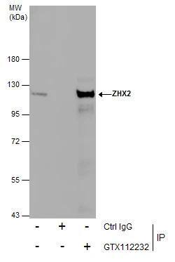 Immunoprecipitation of ZHX2 protein from MCF-7 whole cell extracts using 5 ug of ZHX2 antibody [C1C3] (NBP1-33415).Western blot analysis was performed using ZHX2 antibody [C1C3] (NBP1-33415).EasyBlot anti-Rabbit IgG  was used as a secondary reagent. 