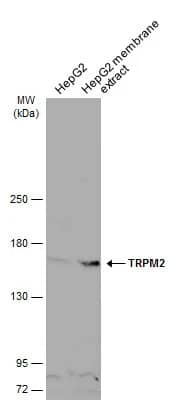 Western Blot: TRPM2 Antibody [NBP1-33416] - HepG2 whole cell and membrane extracts (30 ug) were separated by 5% SDS-PAGE, and the membrane was blotted with TRPM2 antibody [N1N2-2], N-term (NBP1-33416) diluted at 1:500. The HRP-conjugated anti-rabbit IgG antibody  was used to detect the primary antibody, and the signal was developed with Trident ECL plus-Enhanced.