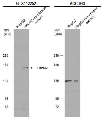 HepG2 whole cell and membrane extracts (30 ug) were separated by 5% SDS-PAGE, and the membranes were blotted with TRPM2 antibody [N1N2-2], N-term (NBP1-33416) diluted at 1:500 and competitor's antibody (ACC-043) diluted at 1:500. The HRP-conjugated anti-rabbit IgG antibody  was used to detect the primary antibody.*The competitor is not affiliated with Novus and does not endorse this product. 
