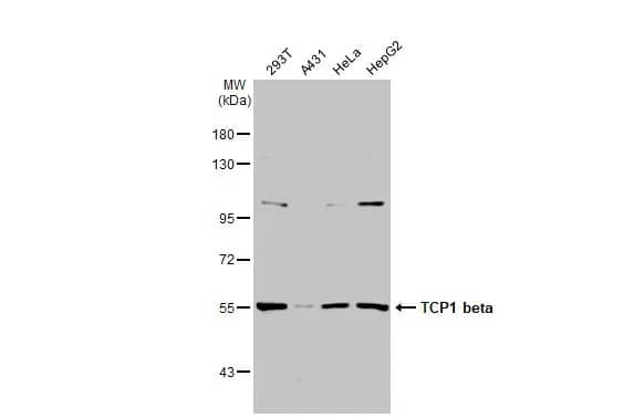 Western Blot: TCP1-beta Antibody [NBP1-33418] - Various whole cell extracts (30 ug) were separated by 7.5% SDS-PAGE, and the membrane was blotted with TCP1-beta antibody [C1C3] (NBP1-33418) diluted at 1:1000. The HRP-conjugated anti-rabbit IgG antibody  was used to detect the primary antibody.