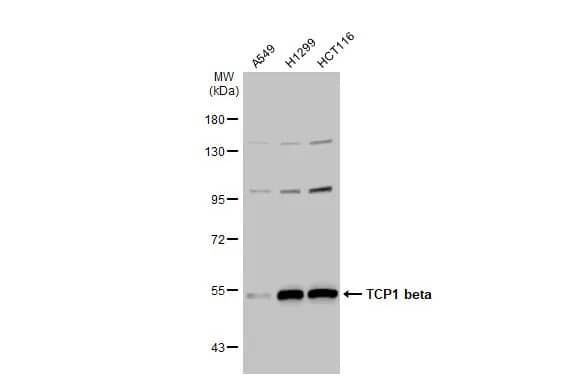 Western Blot: TCP1-beta Antibody [NBP1-33418] - Various whole cell extracts (30 ug) were separated by 7.5% SDS-PAGE, and the membrane was blotted with TCP1-beta antibody [C1C3] (NBP1-33418) diluted at 1:1000. The HRP-conjugated anti-rabbit IgG antibody  was used to detect the primary antibody.